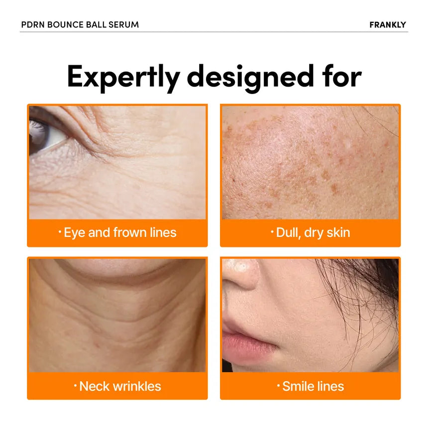 FRANKLY PDRN Bounce Ball Serum (30ml)