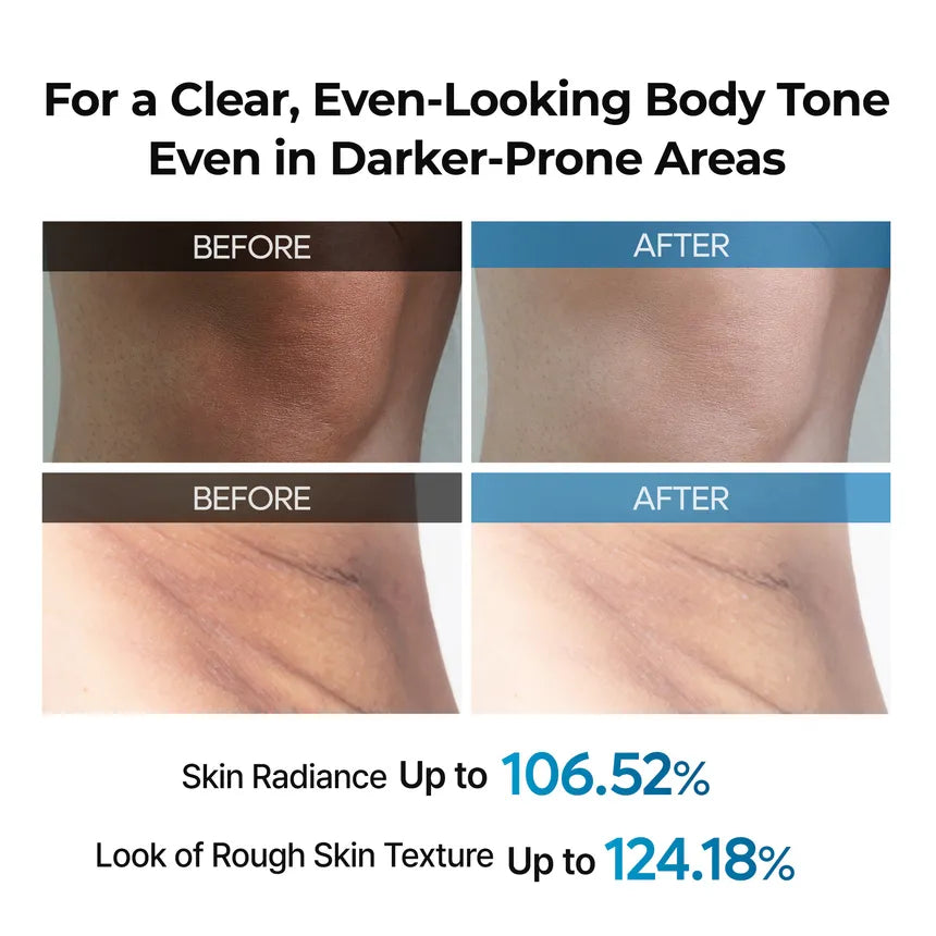 دكتور ميلاكسين بخاخ تقشير TX لتفتيح الجسم وتوحيد اللون وإزالة الجلد الميت بسهولة(200مل)