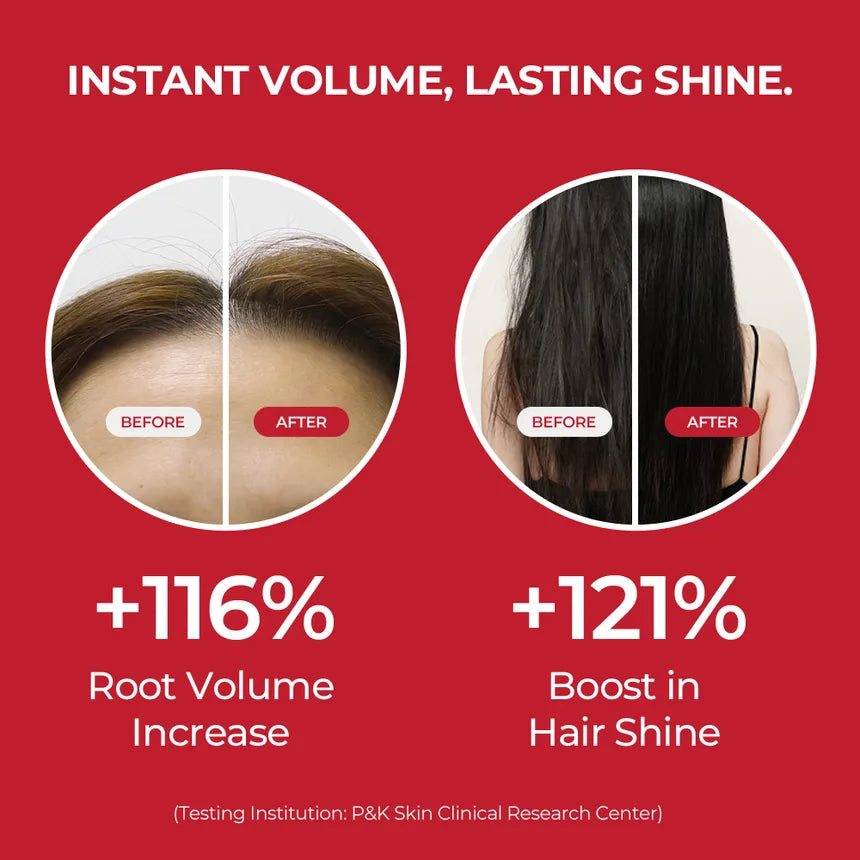 موف شامبو أنوركاتين الجامبو لتحفيز نمو الشعر(525مل)