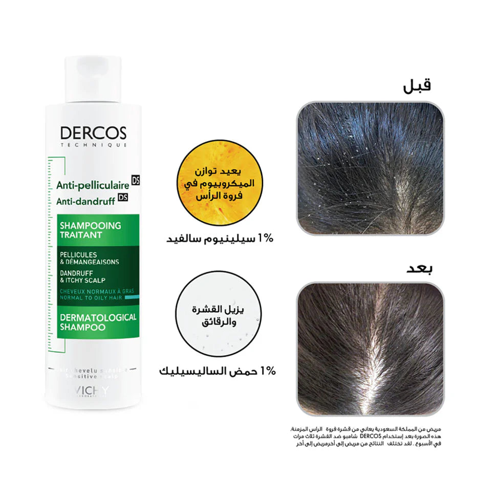 Vichy Dercos Anti-Dandruff Shampoo for Dry Scalp (200ml)
