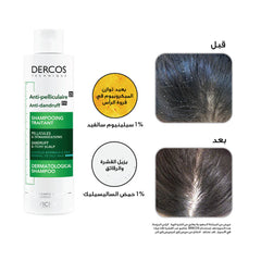 Vichy Dercos Anti-Dandruff Shampoo for Dry Scalp (200ml)