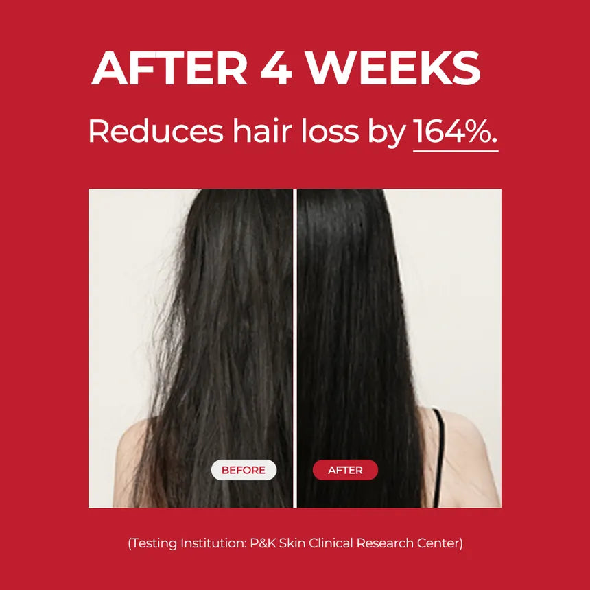 موف تونيك أنوركاتين المغذي لفروة الرأس ومنع التساقط(150مل)