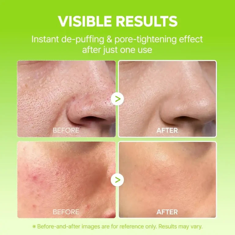 Dr. Milaxin Mist Gel Serum Pore Minimizing (80ml)