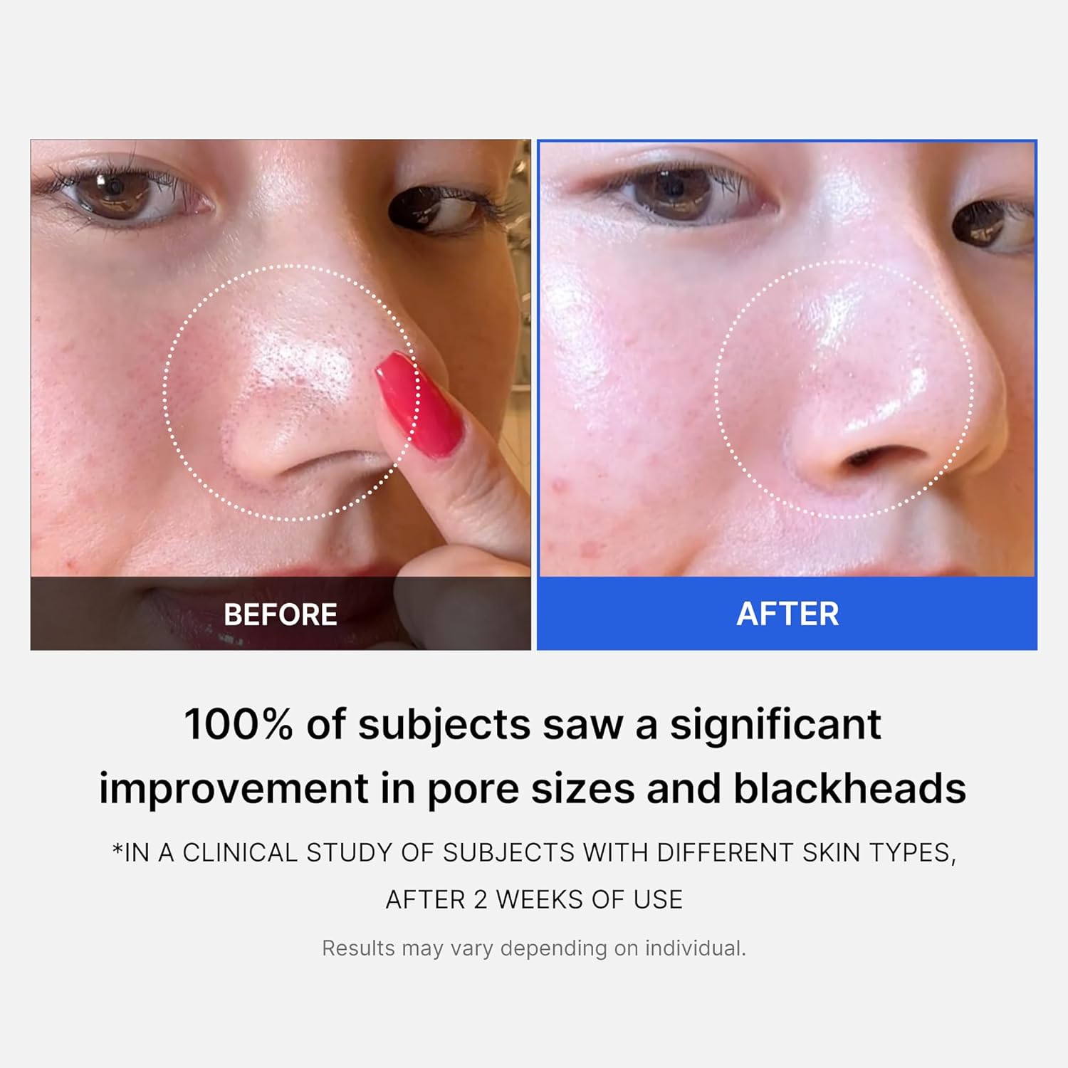 Medicube Zero Pore Pads – Clarifying, Sebum-Control, Pore-Tightening, and Soothing (70 Pads)