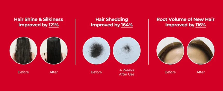 موف شامبو الكافيين والبيوتين  لإنبات وكثافة الشعر(300مل)