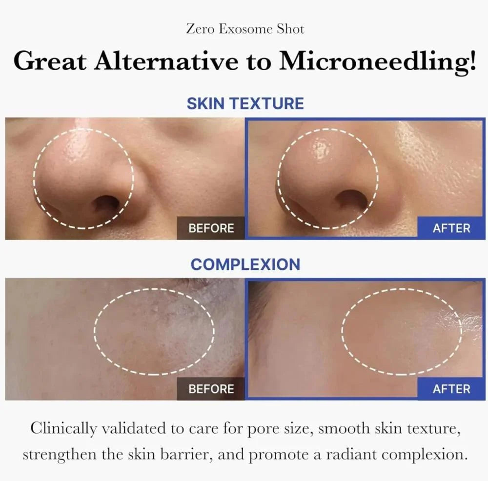 Medicube Exosom Shot One Day Pore Tightening Serum 7500(30ml)