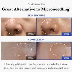 Medicube Exosom Shot One Day Pore Tightening Serum 7500(30ml)