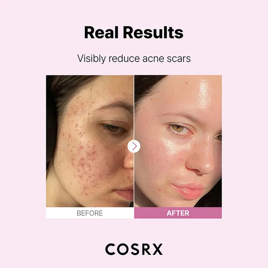 COSRX Niacinamide 15% Serum (20ml)