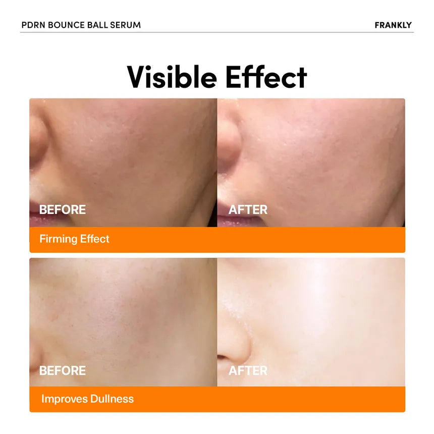FRANKLY PDRN Bounce Ball Serum (30ml)