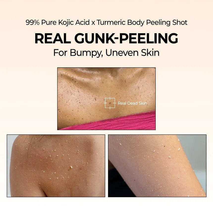 Dr. Melaxin Kojic Acid and Turmeric Body Peeling Spray (200ml)