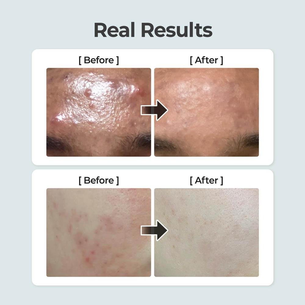 نامبوزين رقم 1 تونر الأعشاب المهدّئ(300مل)