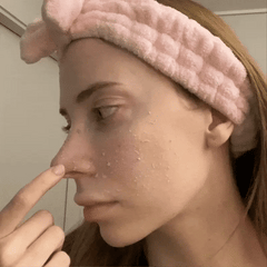 دكتور ميلاكسين أمبول تقشير الأرز الأسود لتنقية المسام وتقليل الرؤوس السوداء(80مل)