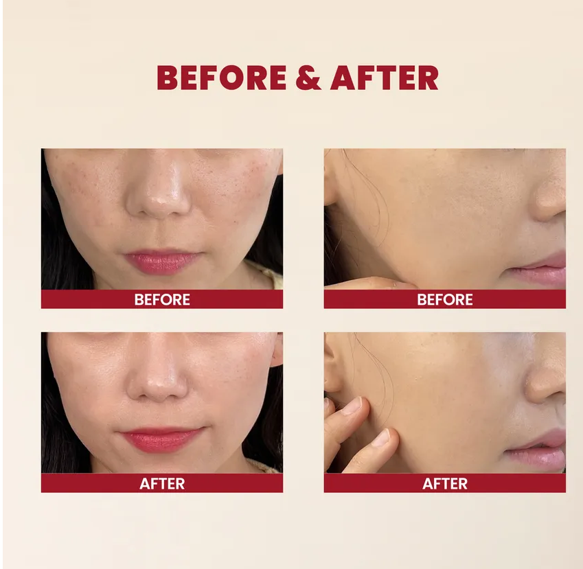 Seoul 1988 Essence Snail &amp; Rice Moisturizing Cream (100ml)